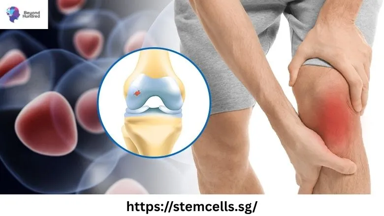 Discover Natural Joint Healing with Non-Surgical Stem Cell Therapy from Singapore