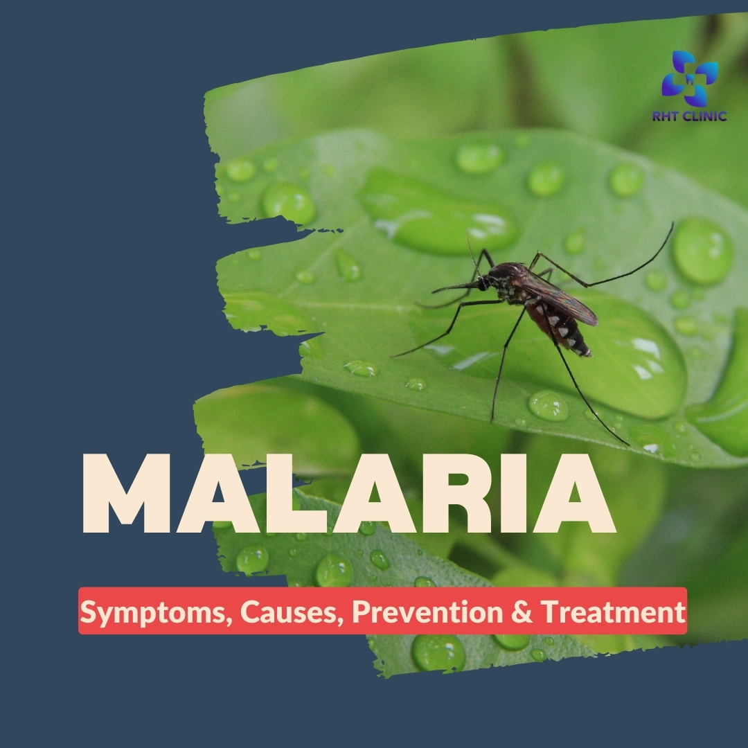 Malaria: Understanding Symptoms, Causes, Prevention & Treatment
